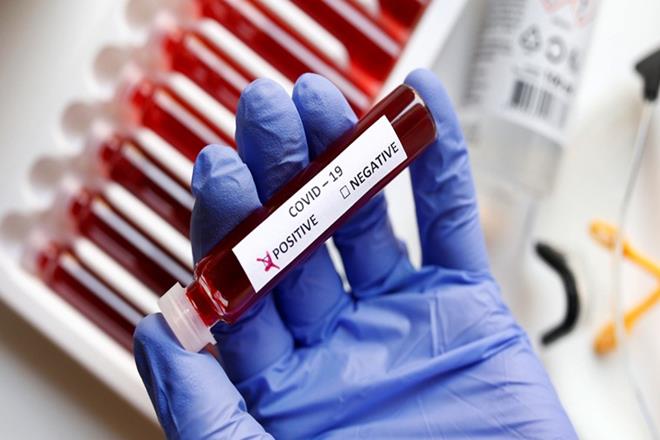 Fighting Coronavirus: The US lends a helping hand! Announces $2.9 million aid to India